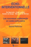 David Petrover - Echo-interventionnelle - Les nouveaux traitements en ostéo-articulaire. De Quervain, canal carpien, tendon du biceps, névrome de Morton.
