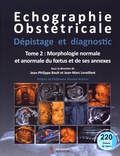 Jean-Philippe Bault et Jean-Marc Levaillant - Echographie obstétricale, dépistage et diagnostic - Tome 2, Morphologie normale et anormale du foetus et de ses annexes.