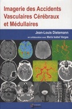 Jean-Louis Dietemann - Imagerie des accidents vasculaires cérébraux et médullaires.