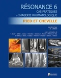 Jean-Denis Laredo - Résonance - Tome 6, Cas pratiques en imagerie rhumatologique : pied et cheville.