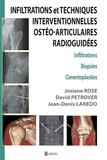 Josiane Rose et David Petrover - Infiltrations et Techniques Interventionnelles ostéo-articulaires radioguidées - Infiltrations, Biopsies, Cimentoplasties.