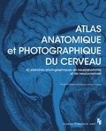 Vincent Di Marino et Yves Etienne - Atlas anatomique et photographique du cerveau - 42 planches (dont 41 photographiques) de neuroanatomie et de neuroscience.