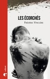 Frédéric Vinclère - Les écorchés.