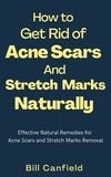  Bill Canfield - How to Get Rid of Acne Scars and Stretch Marks Naturally.
