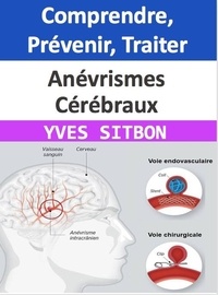  YVES SITBON - Anévrismes Cérébraux : Comprendre, Prévenir, Traiter.