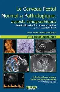 Le cerveau foetal normal et pathologique : aspects échographiques