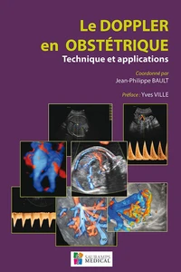 Le doppler en obstétrique