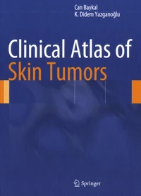 Clinical Atlas of Skin Tumors