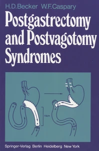 Postgastrectomy and Postvagotomy Syndromes