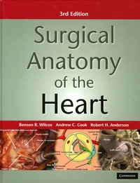 Surgical Anatomy of the Heart
