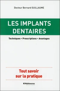 Les implants dentaires