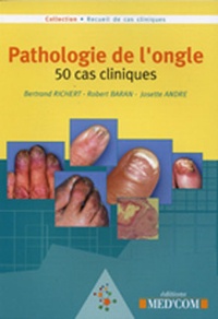 Bertrand Richert et Robert Baran - Pathologie de l'ongle - 50 cas cliniques.