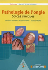 Pathologie de l'ongle
