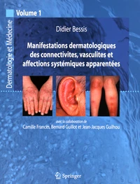 Manifestations dermatologiques des connectivites, vasculites et affections systémiques apparentées