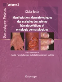 Manifestations dermatologiques des maladies du système hématopoïétique et oncologie dermatologique