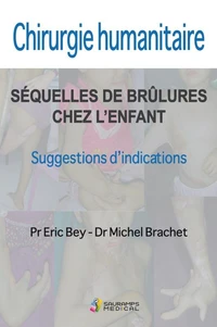 Chirurgie humanitaire. Séquelles de brûlures chez l'enfant