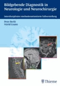 Bildgebende Diagnostik in der Neurologie und Neurochirurgie - Interdisziplinäre methodenorientierte Fallvorstellung.
