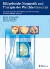Bildgebende Diagnostik und Therapie der Weichteiltumoren - mit pathologischer Klassifikation, Nuklearmedizin, interventioneller Therapie.