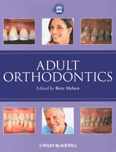 Birte Melsen - Adult Orthodontics.
