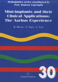 Mini-implants and their Clinical Applications