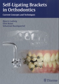 Björn Ludwig et Dirk Bister - Self-Ligating Brackets in Orthodontics - Current Concepts and Techniques.