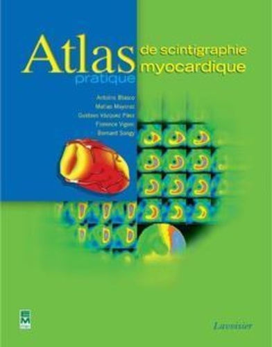 Blasco - Atlas de scintigraphie myocardique.