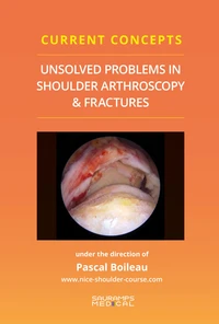 Unsolved problems in shoulder arthroscopy & fractures