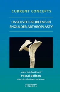 Unsolved problems in shoulder arthroscopy & fractures
