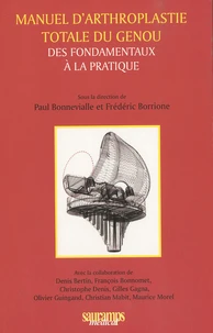 Manuel d'arthroplastie totale du genou