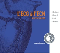L'ECG à l'ECN en 75 tracés