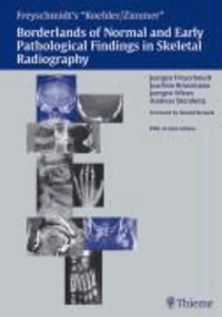 Borderlands of Normal and Early Pathologic Findings in Skeletal Radiograph - Freyschmidt's "Koehler/Zimmer".