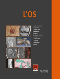L'os