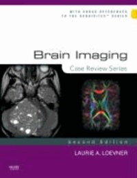 Brain Imaging - Case Review Series.