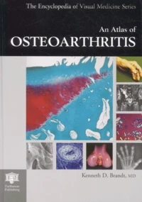 An Atlas Of Osteoarthritis