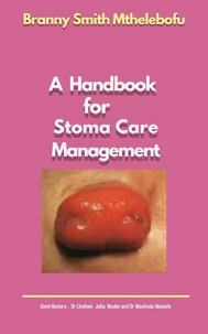 A Handbook for Stoma Care Management