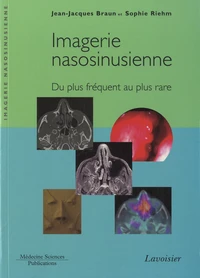 Imagerie nasosinusienne