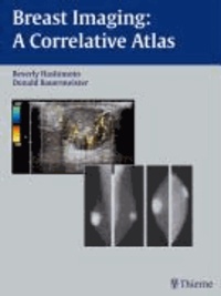 Breast Imaging - A Correlative Atlas.