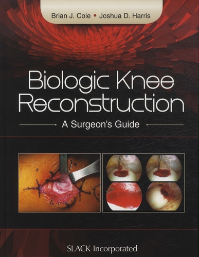 Brian-J Cole et Joshua-D Harris - Biologic Knee Reconstruction - A Surgeon's Guide.