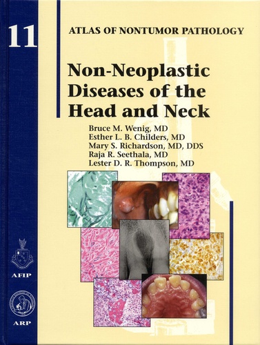 Bruce-M Wenig et Esther L-B Childers - Non-Neoplastic Diseases of the Head and Neck - Atlas of Nontumor Pathology.