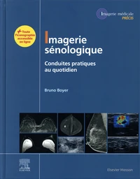 Imagerie sénologique