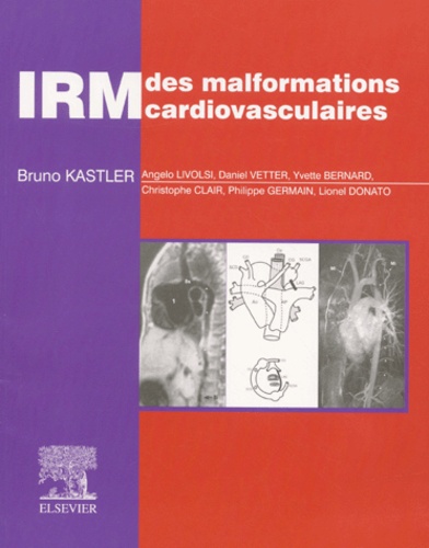 Bruno Kastler et  Collectif - IRM des malformations cardiovasculaires.
