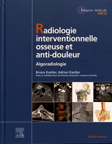Radiologie Interventionnelle osseuse et anti-douleur. Algoradiologie