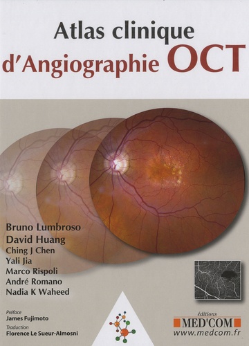 Bruno Lumbroso et David Huang - Atlas clinique d'angiographie OCT.