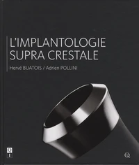 L'implantologie supracrestale