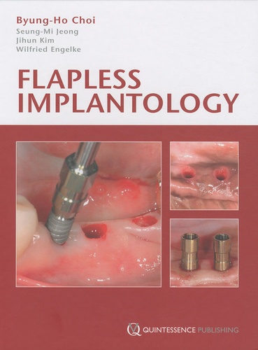Byoung-Ho Choi - Flapless Implantology.