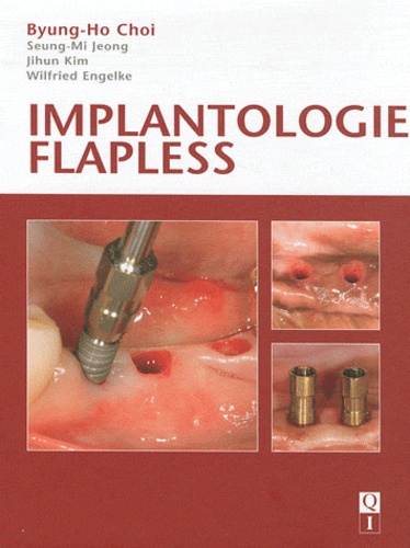 Implantologie flapless