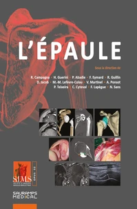 L'épaule