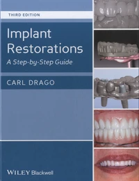 Implant Restorations