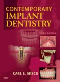 Carl E. Misch - Contemporary Implant Dentistry.