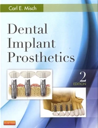 Dental Implant Prosthetics